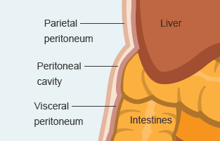 Peritoneal Mesothelioma - Peritoneum Diagram 