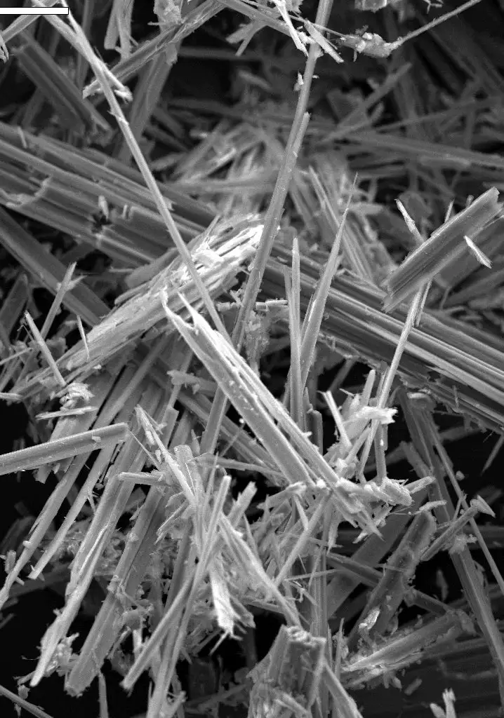 Signs And Symptoms Of Asbestosis: Asbestos Exposure And The Resulting Illnesses