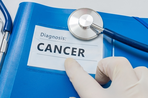 A To C: Understanding How Asbestos Exposure Can Lead To A Cancer Diagnosis